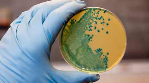 Listeria monocytogenes que crece en una placa de agar (Foto Envato)