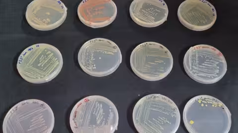 Ejemplos de bacterias aisladas (Foto Fundaci&oacute;n Descubre)