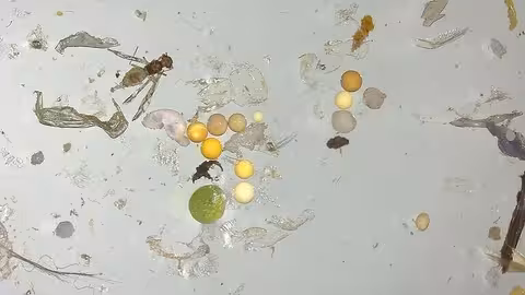 Micropl&aacute;sticos vistos al microscopio (Foto Greenpeace)