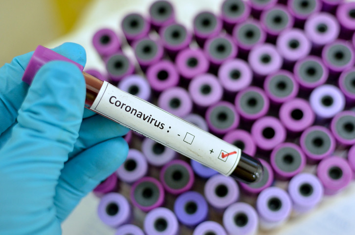 Coronavirus tubo de ensayo (Foto UGT)