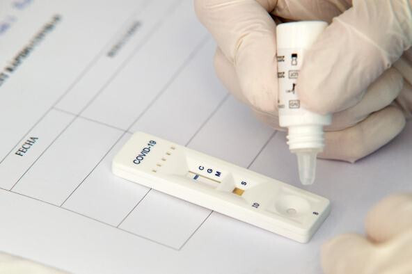 Prueba Covid 19 coronavirus (Foto Gobierno de CLM)